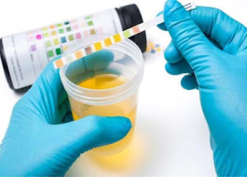 यूरिन का बदलता रंग हो सकता हैं गभीर बीमारी की निशाना, यहां जानिए यूरिन के रंगों का मतलब