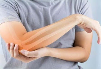 आजकल का खानपान हड्डियों के लिए ऐसे बन रहा खतरा