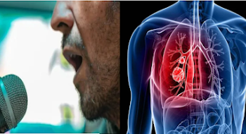 दोस्त की पार्टी में गाना गाया, हुआ इतना बुरा हाल