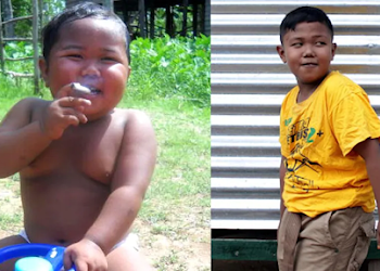 दो साल का बच्‍चा चेन स्‍मोकर बन हर दिन पीता था 40 सिगरेट, अब दिखता है ऐसा