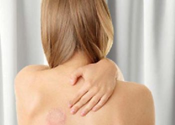 गर्मी में हो सकती है चर्म रोगों की समस्या, ऐसे करें बचाव