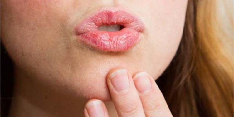 फटे होठों को ऐसे बनाएं मुलायम