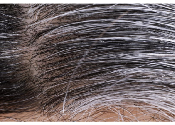 30 की उम्र में ही बाल होने लगे हैं सफेद? इस तेल से 7 दिन में मिलेगा सफेद बालो से छुटकारा