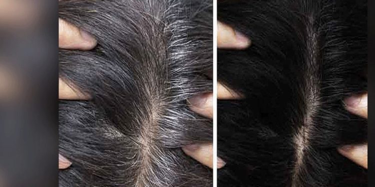 छोटी उम्र में क्यों सफेद हो जाते हैं बाल?, घरेलू उपायों से बालों को काला करें