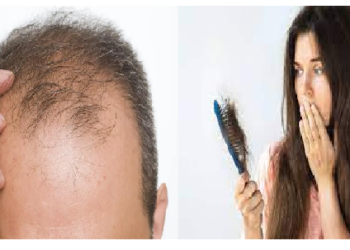 आज से ही खाना छोड़ दें ये 5 चीजें, वरना जल्दी हो जाएंगे गंजेपन के शिकार