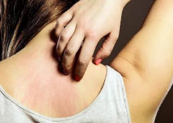 इन छोटे-छोटे उपायों से दूर होगी रूखी त्वचा से खुजली