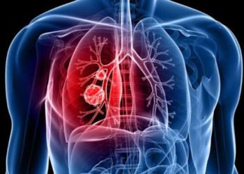 क्यों बढ़ रही है फेफड़ें की बीमारी के रोगियों की तादाद बढ़ रही