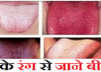जीभ का रंग भी बता देती है बीमारियां, जानिए क्या आपकी जीभ भी तो नहीं है ऐसी