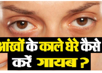 आंखों के काले घेरे जड़ से निकाल फेंकती हैं ये 3 चीजें, ये है इस्‍तेमाल का सही तरीका
