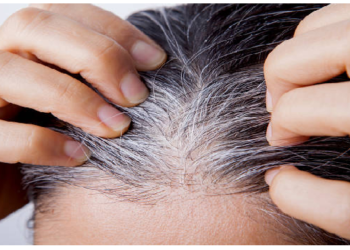 कई वजहों से हो सकती है सफेद बाल की समस्या, घने और काले बाल के लिए करें ये काम