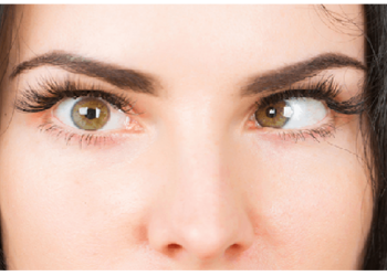 आंखों के भैंगेपन की वजह से बढी एली की डिमांड, लडकी भैंगेपन से कमा रही पैसे, अब बनी कॉलेज टॉपर