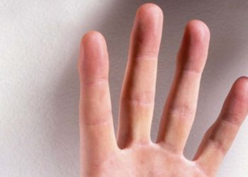 अगर आपके हाथ पर हैं ये निशान तो आप करेंगे खूब यात्राएं