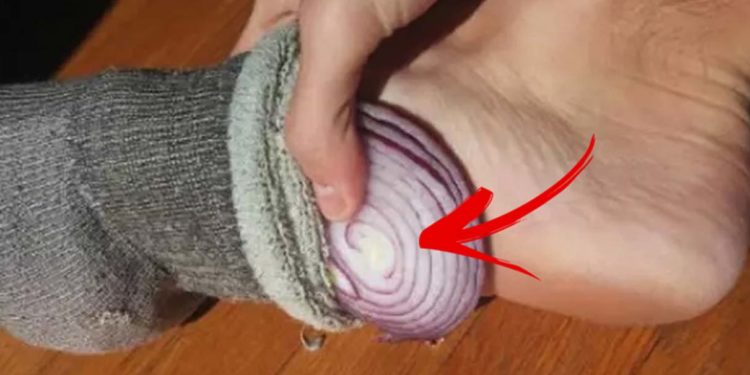 क्यों सोने से पहले मोजे में प्याज रखकर सोते हैं लोग, जानिए प्याज के अचूक फायदे