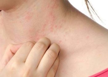 गर्मी में चर्म रोगों से ऐसे करें बचाव