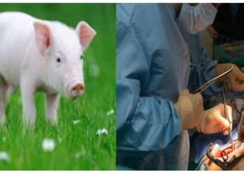 ट्रांसप्‍लांट की दुनिया में चमत्कार, इंसान के शरीर में काम कर गई सुअर की किडनी