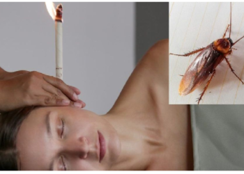 महिला के कान में था दर्द, अंदर से निकाला ‎जिंदा कॉकरोच