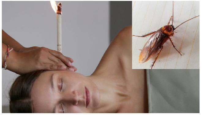 महिला के कान में था दर्द, अंदर से निकाला ‎जिंदा कॉकरोच