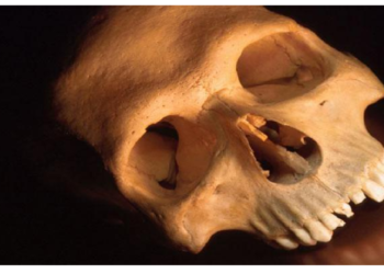 मनुष्‍य की खोपड़ी से बनाई जाती थी मिर्गी की दवा, इंसानी लाशों से कर दी जाती थीं गंभीर बीमारियां ठीक