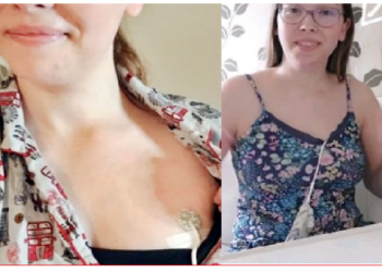 को‎विड के बाद एक म‎हिला मुंह के बजाय दिल से खाती है खाना