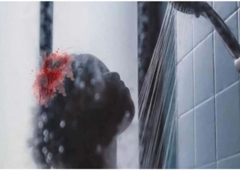 डरावनी एलर्जी से परेशान है म‎हिला, नहाने पर सिर से बहता है खून