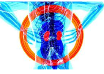 इंटरनेट का ज्ञान पड़ा मंहगा….महिला की किडनी में हुआ संक्रमण