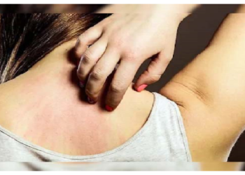 रूखी त्वचा से खुजली ऐसे होगी दूर