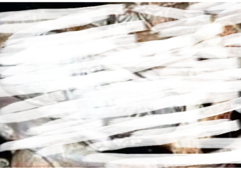 अजब-गजब: 73 साल की म‎हिला ने करवाई जांच, ‎निकला 35 साल का बच्चा