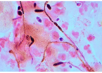 अमेरिका में फैल रहा कैंडिडा ऑरिस नामक बेहद घातक संक्रमण, मचा हड़कंप