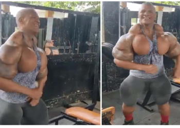 इंजेक्शन लगाकर बना ली ऐसी बॉडी, लोग बोले बुलडोजर