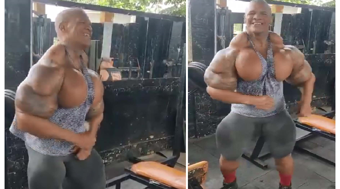 इंजेक्शन लगाकर बना ली ऐसी बॉडी, लोग बोले बुलडोजर