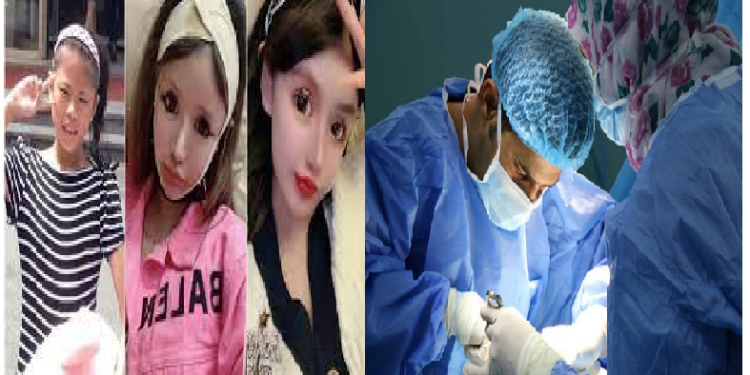 13 साल की लडकी को लगी सर्जरी की लत, पढाई भी छोड दी, कराई 100 सर्जरी