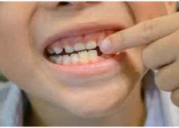 बच्चे के दूध के दाँतों की देखभाल जरुरी