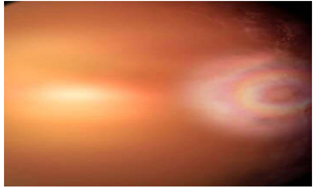 वैज्ञानिकों ने पहली बार देखी ग्लोरी इफेक्ट नाम की दुर्लभ घटना