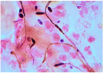 दक्षिणी ध्रुव से निकला नया वायरस पूरी दुनिया में मचाएगा तबाही!