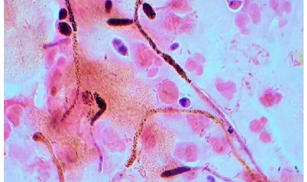 दक्षिणी ध्रुव से निकला नया वायरस पूरी दुनिया में मचाएगा तबाही!