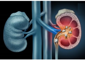 शरीर के संकेतों को ना करें नजरअंदाज