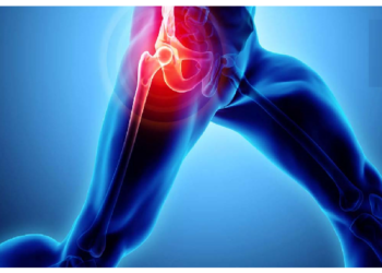 कूल्हे का दर्द और उसके कारण, ऐसे पहचानें लक्षण