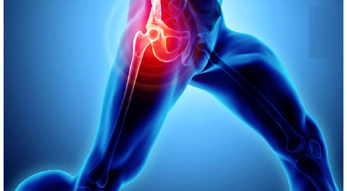 कूल्हे का दर्द और उसके कारण, ऐसे पहचानें लक्षण