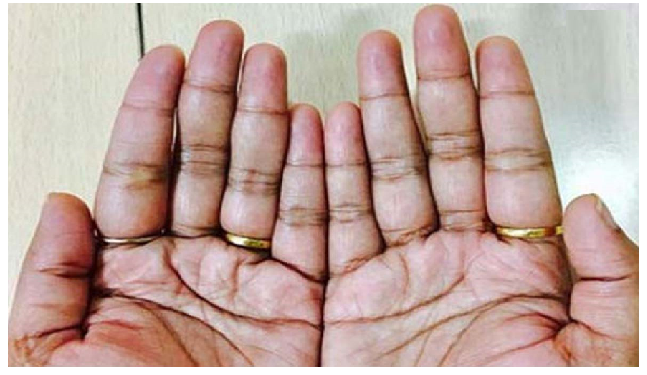 वर-वधू का योग देखने में हस्‍तरेखा का हो सकता है अहम योगदान