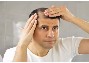 गंजेपन से पाना चाहते हैं छुटकारा तो आजमाएं ये टिप्स
