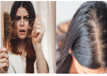 हेयरफॉल प्रॉब्लम में मददगार हो सकती हैं ये ड्रिंक्स, चंद दिनों में दिखने लगेगा असर