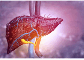स्वास्थ्य के लिए बेहद खतरनाक हो सकता है फैटी लिवर