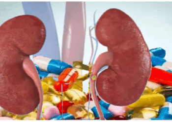 खबरदार…..ये सप्लीमेंट आपकी किडनी के लिए साइलेंट किलर