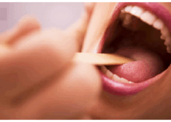 जीभ का रंग, बनावट में छुपे होते है गंभीर बीमारियों के संकेत