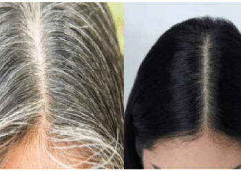 इन आसान उपायों से सफेद बाल होंगे काले