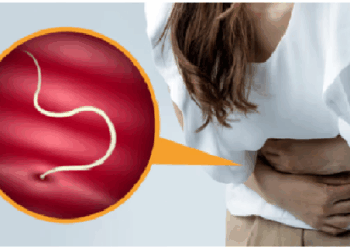 बच्चों के पेट में कीड़ों का करें घरेलू उपाय