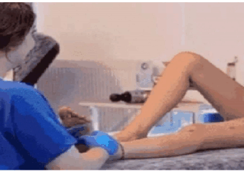 कद घटाने तुर्की में महिलाएं करवा रही लिंब-शॉर्टनिंग ऑपरेशन