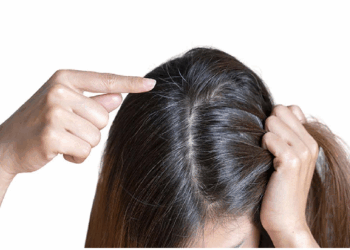 सफेद बाल इस प्रकार होंगे काले, एक बार ट्राई करें ये घरेलू उपाय