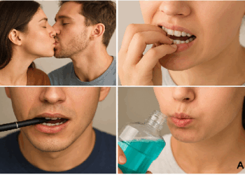 पार्टनर को किस करने से भी होते है दांत खराब