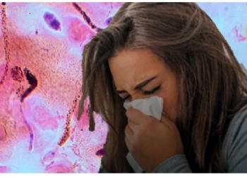 कफ दोष बढ़ने से होती है गले में जलन और सूजन